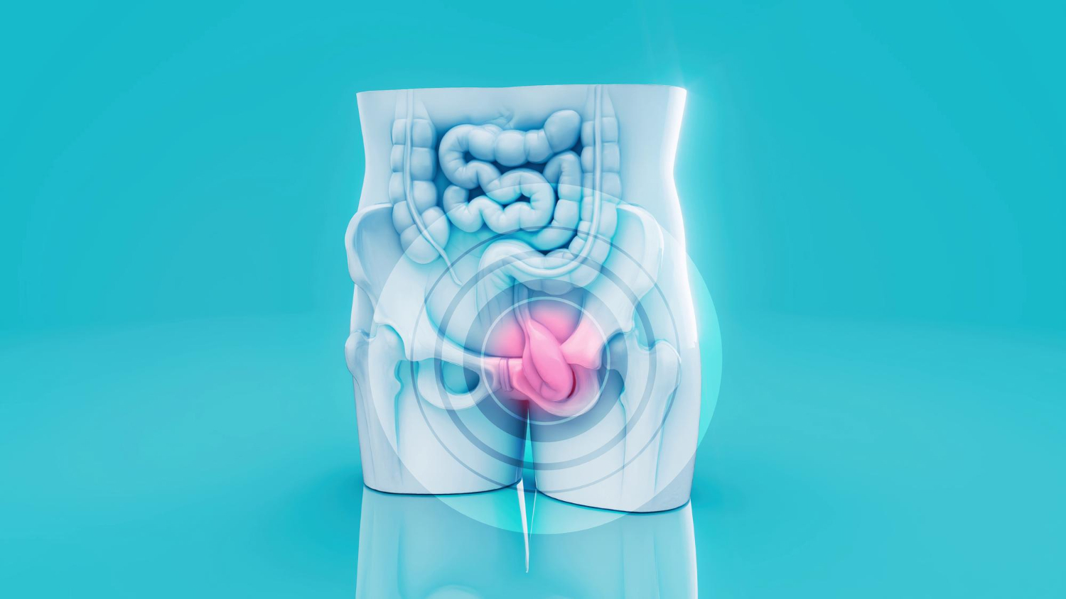 Hernia